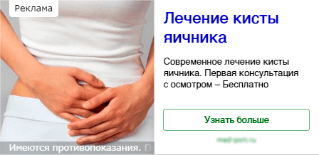 Пример тексто-графического объявления в Яндекс Директе